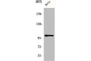 Western Blot analysis of HeLa cells using Phospho-NFκB-p105 (S907) Polyclonal Antibody
