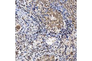 IHC analysis of SNRNP200 using anti-SNRNP200 antibody (ABIN7602032).
