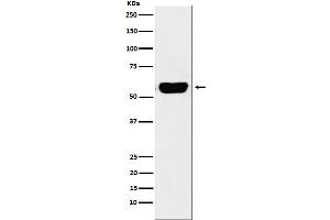 Western blot analysis of Salivary alpha amylase expression in Human pancreas lysate.