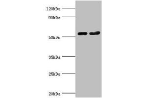 Western blot All lanes: Septin-7 antibody at 9 μg/mL Lane 1: Hela whole cell lysate Lane 2: Mouse gonad tissue Secondary Goat polyclonal to rabbit IgG at 1/10000 dilution Predicted band size: 51 kDa Observed band size: 51 kDa (Septin 7 anticorps  (AA 308-437))