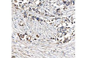 IHC analysis of CPT1A using anti-CPT1A antibody (ABIN7599853). (CPT1A anticorps  (AA 122-556))