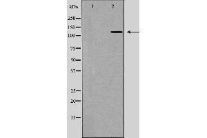 Western blot analysis of Hela whole cell lysates, using UPF1  Antibody. (RENT1/UPF1 anticorps)