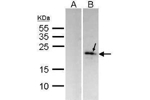 WB Image Western Blot analysis of MKP-6 expression in transfected 293T cell line (20ug of whole cell ltsate) A: Non-transfected lysate. (DUSP14 anticorps  (C-Term))