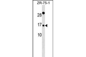 TI Antibody (Center) (ABIN6242753 and ABIN6577350) western blot analysis in ZR-75-1 cell line lysates (35 μg/lane). (TIMM9 anticorps  (AA 18-44))