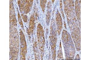 IHC analysis of HGD using anti-HGD antibody (ABIN7601528).