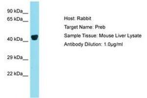 Image no. 1 for anti-Prolactin Regulatory Element Binding (PREB) (N-Term) antibody (ABIN6750398) (PREB anticorps  (N-Term))