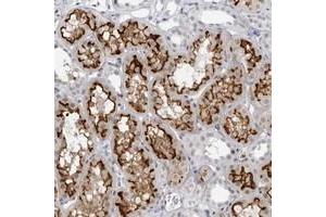 Immunohistochemical staining of human kidney with ESPN polyclonal antibody  shows strong membranous and weak nuclear positivity in tubular cells. (Espin anticorps)