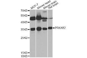 Western blot analysis of extracts of various cell lines, using PRKAB2 antibody (ABIN6291758) at 1:1000 dilution. (PRKAB2 anticorps)