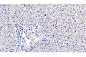 Detection of NOS2 in Human Liver Tissue using Monoclonal Antibody to Nitric Oxide Synthase 2, Inducible (NOS2)