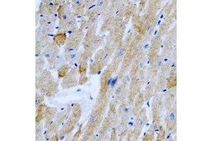 Immunohistochemical analysis of OGT staining in rat heart formalin fixed paraffin embedded tissue section.