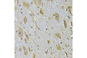Immunohistochemistry of paraffin-embedded mouse brain using ITGA2 Antibody (ABIN2563445) at dilution of 1:100 (40x lens). (ITGA2 anticorps)