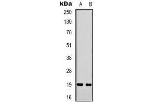 Western blot analysis of STMN1 expression in Hela (A), COS7 (B) whole cell lysates. (Stathmin 1 anticorps  (N-Term))