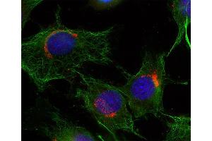 Immunocytochemistry (ICC) image for anti-RAB6A, Member RAS Oncogene Family (RAB6A) (AA 1-205) antibody (ABIN1742534)