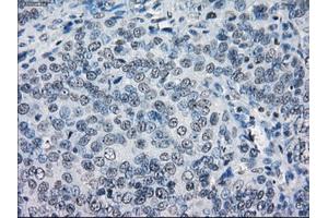 Immunohistochemical staining of paraffin-embedded colon tissue using anti-LTA4Hmouse monoclonal antibody. (LTA4H anticorps)
