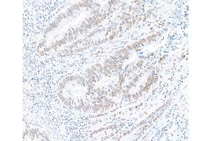 Immunohistochemistry (IHC) image for anti-Splicing Factor Proline/glutamine-Ric (SFPQ) (AA 225-275) antibody (ABIN7453761)