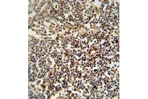 Immunohistochemistry analysis in human lymph node (formalin-fixed, paraffin-embedded) using LAPTM5  Antibody  (N-term), followed by peroxidase conjugation of the secondary antibody and DAB staining.