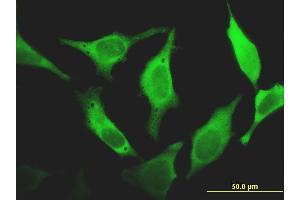 Immunofluorescence of monoclonal antibody to FHIT on HeLa cell. (FHIT anticorps  (AA 31-130))