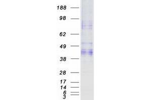 Validation with Western Blot