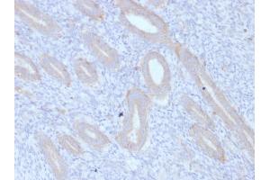 Formalin-fixed, paraffin-embedded human Endometrium stained with ATG5 Mouse Monoclonal Antibody (ATG5/2553). (ATG5 anticorps  (AA 1-119))