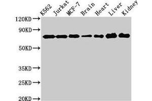 Western Blot Positive WB detected in: K562 whole cell lysate, Jurkat whole cell lysate, MCF-7 whole cell lysate, Rat brain tissue, Rat heart tissue, Mouse liver tissue, Mouse kidney tissue All lanes: DDX3X antibody at 3 μg/mL Secondary Goat polyclonal to rabbit IgG at 1/50000 dilution Predicted band size: 74, 72 kDa Observed band size: 74 kDa (DDX3X anticorps  (AA 2-662))