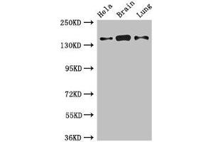 Western Blot Positive WB detected in: Hela whole cell lysate, Mouse brain tissue, Rat lung tissue All lanes: SULF2 antibody at 2. (SULF2 anticorps  (AA 463-660))