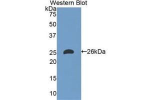Detection of Recombinant APOM, Human using Polyclonal Antibody to Apolipoprotein M (APOM) (Apolipoprotein M anticorps  (AA 8-188))