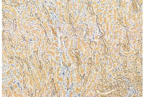 ABIN6261290 and ABIN6272914 at 1/100 staining Rat kidney tissue by IHC-P. (DHRS3 anticorps  (Internal Region))