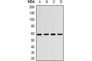 Western blot analysis of Monoamine Oxidase B expression in SW480 (A), Hela (B), mouse brain (C), mouse heart (D) whole cell lysates.