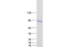 Validation with Western Blot