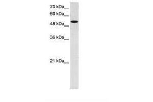 Image no. 1 for anti-Solute Carrier Family 25 (Mitochondrial Carrier, Phosphate Carrier), Member 25 (SLC25A25) (AA 71-120) antibody (ABIN6736655) (SLC25A25 anticorps  (AA 71-120))