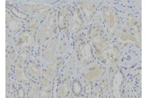 ABIN6273751 at 1/100 staining Mouse kidney tissue by IHC-P. (CYP17A1 anticorps  (Internal Region))