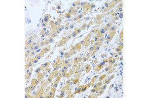Immunohistochemistry of paraffin-embedded human liver using STC1 antibody at dilution of 1:100 (40x lens). (Stanniocalcin 1 anticorps)