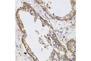 Immunohistochemistry of paraffin-embedded human prostate using CAST antibody (ABIN5970004) at dilution of 1/100 (40x lens). (Calpastatin anticorps)