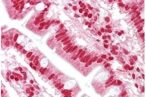 Anti-OAS1 antibody IHC staining of human small intestine. (OAS1 anticorps  (AA 324-373))
