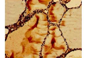Immunohistochemistry of paraffin-embedded human thyroid tissue using ABIN7167354 at dilution of 1:100