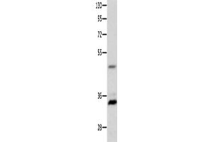 Western Blotting (WB) image for anti-Melanocortin 1 Receptor (MC1R) antibody (ABIN2426175) (MC1 Receptor anticorps)