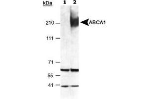 Detection of ABCA1 in mouse peritoneal macrophages using ABCA1 polyclonal antibody . (ABCA1 anticorps  (AA 1100-1300))