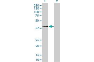 Western Blot analysis of HSD3B2 expression in transfected 293T cell line by HSD3B2 MaxPab polyclonal antibody. (HSD3B2 anticorps  (AA 1-372))