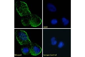 Immunofluorescence staining of fixed MCF7 cells with anti-Fas antibody R-125224. (Recombinant FAS anticorps)
