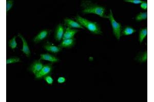 Immunofluorescence staining of Hela cells with ABIN7173964 at 1:133, counter-stained with DAPI. (INPP5B anticorps  (AA 78-178))