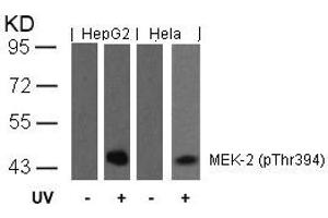 Western blot analysis of extracts from HepG2 and Hela cells untreated or treated with UV using MEK-2(Phospho-Thr394) Antibody.