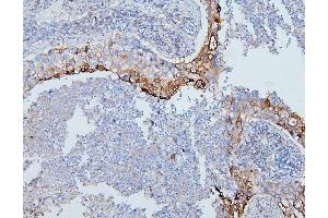 IHC analysis of PYROXD1 using anti-PYROXD1 antibody (ABIN6719650). (PYROXD1 anticorps  (AA 48-230))