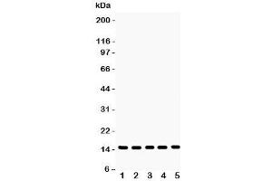 Western blot testing of Profilin-1 antibody and Lane 1:  rat testis;  2: mouse testis;  3: human placenta;  4: (h) PANC;  5: (h) SW620 lysate. (PFN1 anticorps  (C-Term))