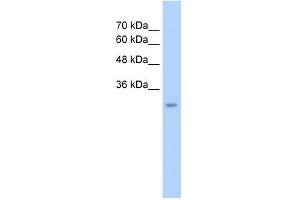 WB Suggested Anti-GEM Antibody Titration:  2. (GEM anticorps  (C-Term))