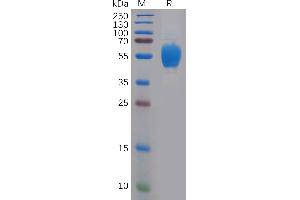 Human F Protein, His Tag on SDS-PAGE under reducing condition.