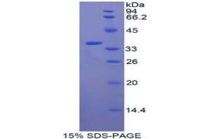 SDS-PAGE analysis of Human CRAF Protein. (CRAF Protéine)