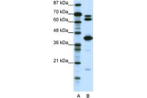 WB Suggested Anti-E2F2 Antibody Titration: 0. (E2F2 anticorps  (Middle Region))