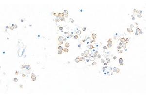 Immunohistochemistry (IHC) image for anti-Hepatitis A Virus Cellular Receptor 2 (TIM 3) (AA 22-201) antibody (ABIN7449550) (Recombinant TIM3 anticorps  (AA 22-201))