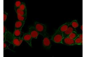 ABIN6383801 to EpCAM was successfully used to stain cellular membranes in cell line MCF7 and in human colorectal carcinoma.