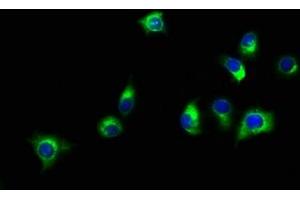 Immunofluorescence staining of A549 cells with ABIN7160157 at 1:150, counter-stained with DAPI.